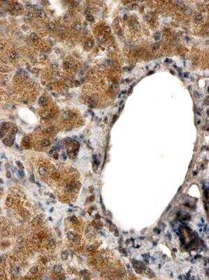 Immunohistochemistry-Paraffin: FALDH Antibody [NBP2-42510]