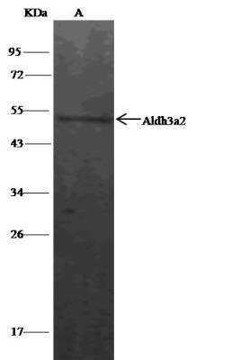 Immunoprecipitation: FALDH Antibody [NBP2-99236]