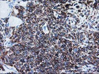 Immunohistochemistry: FALDH Antibody (OTI2A7) - Azide and BSA Free [NBP2-70159]