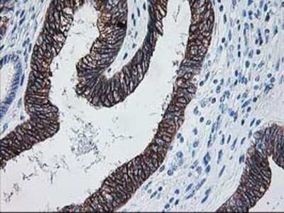 Immunohistochemistry: FALDH Antibody (OTI2A7) - Azide and BSA Free [NBP2-70159]