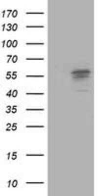 Western Blot: FALDH Antibody (OTI2A7)Azide and BSA Free [NBP2-70159]