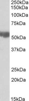 Western Blot: FALDH Antibody [NBP1-52056]