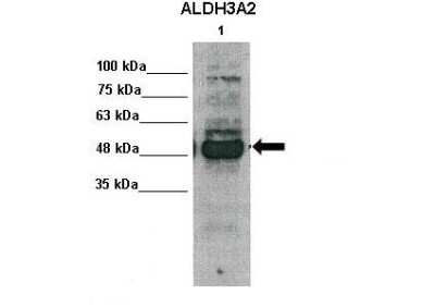 Western Blot: FALDH Antibody [NBP1-59679]