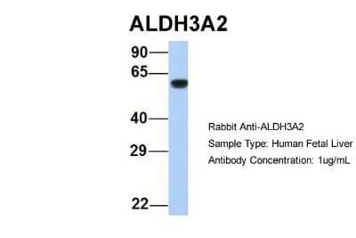 Western Blot: FALDH Antibody [NBP1-59679]