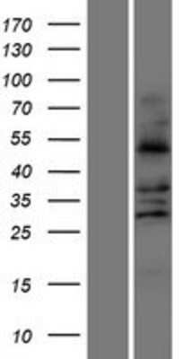 Western Blot: FALDH Overexpression Lysate [NBP2-11169]