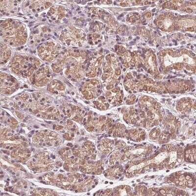 Immunohistochemistry-Paraffin: FAM100A Antibody [NBP2-38094]