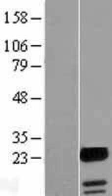 Western Blot: FAM100A Overexpression Lysate [NBL1-10434]