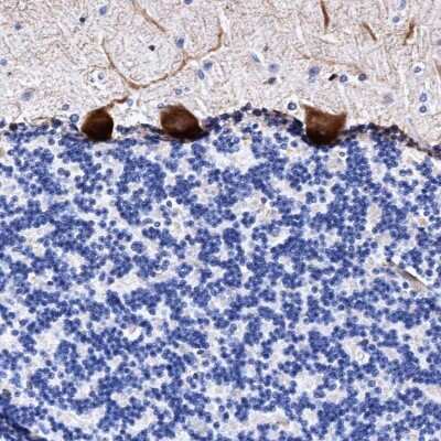 Immunohistochemistry-Paraffin: FAM100B Antibody [NBP1-93496]
