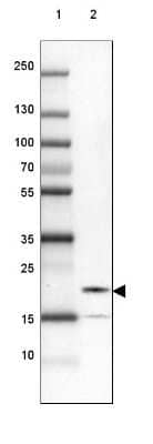 Western Blot: FAM100B Antibody [NBP1-93496]