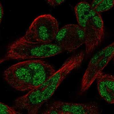 Immunocytochemistry/ Immunofluorescence: FAM101A Antibody [NBP2-58508]