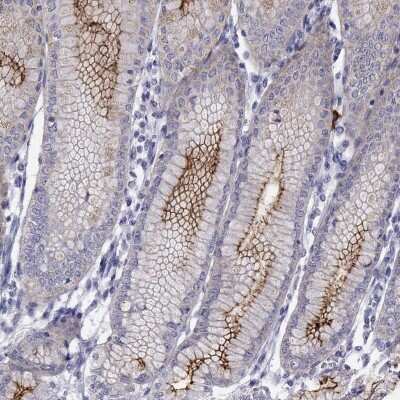 Immunohistochemistry-Paraffin: FAM101A Antibody [NBP2-62722]