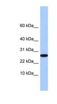 Western Blot: FAM101A Antibody [NBP1-79528]