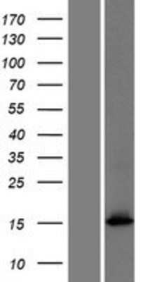 Western Blot: FAM101A Overexpression Lysate [NBP2-04898]