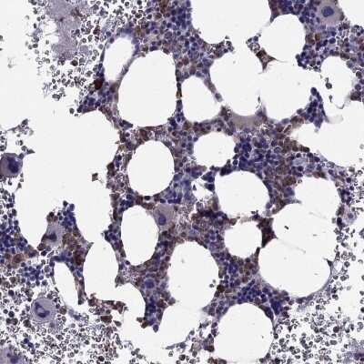 Immunohistochemistry-Paraffin: FAM101B Antibody [NBP2-62633]