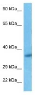 Western Blot: FAM102A Antibody [NBP3-10723]