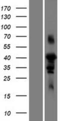 Western Blot: FAM102A Overexpression Lysate [NBP2-08585]