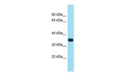 Western Blot: FAM102B Antibody [NBP2-83032]