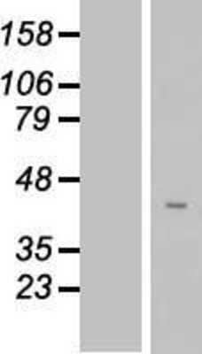 Western Blot: FAM102B Overexpression Lysate [NBP2-08767]