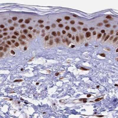 Immunohistochemistry-Paraffin: FAM103A1 Antibody [NBP1-88435]