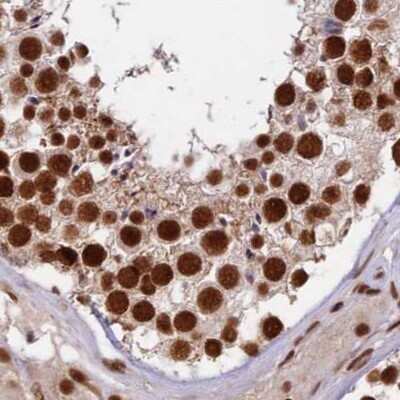 Immunohistochemistry-Paraffin: FAM103A1 Antibody [NBP1-88435]