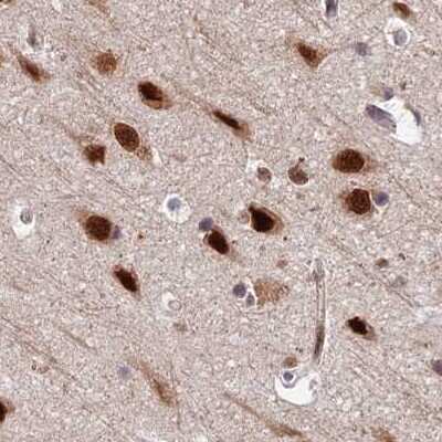 Immunohistochemistry-Paraffin: FAM103A1 Antibody [NBP1-88435]