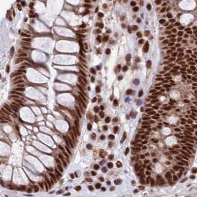 Immunohistochemistry-Paraffin: FAM103A1 Antibody [NBP1-88435]