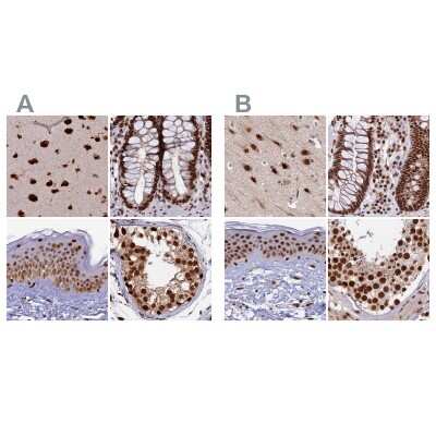 Immunohistochemistry-Paraffin: FAM103A1 Antibody [NBP1-88436]