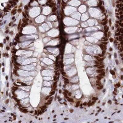 Immunohistochemistry-Paraffin: FAM103A1 Antibody [NBP1-88436]