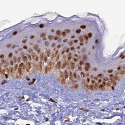 Immunohistochemistry-Paraffin: FAM103A1 Antibody [NBP1-88436]