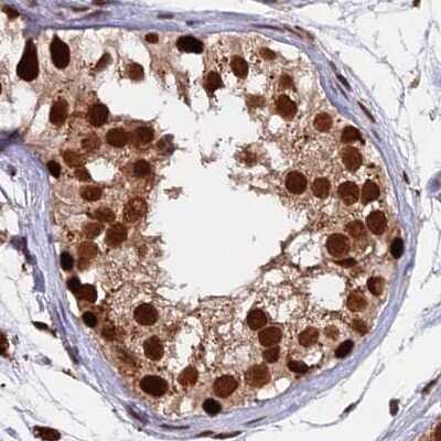 Immunohistochemistry-Paraffin: FAM103A1 Antibody [NBP1-88436]
