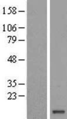 Western Blot: FAM103A1 Overexpression Lysate [NBL1-10435]