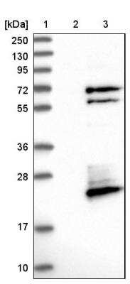 Western Blot: FAM104A Antibody [NBP1-94005]