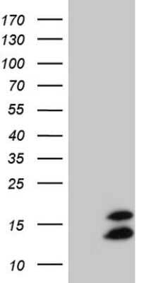 Western Blot: FAM104B Antibody (OTI1D10) [NBP2-45576]