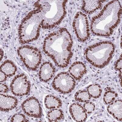 Immunohistochemistry-Paraffin: FAM104B Antibody [NBP2-13974]