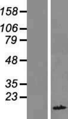 Western Blot: FAM104B Overexpression Lysate [NBL1-10436]