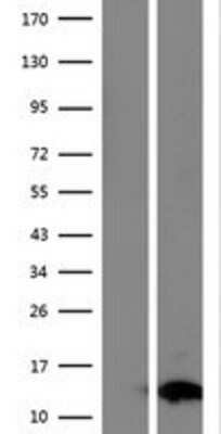 Western Blot: FAM104B Overexpression Lysate [NBP2-10242]