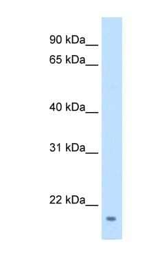 Western Blot: FAM107A Antibody [NBP1-54335]