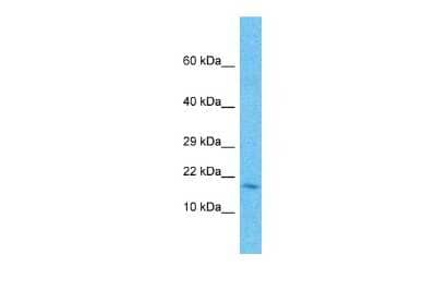 Western Blot: FAM107A Antibody [NBP2-87397]