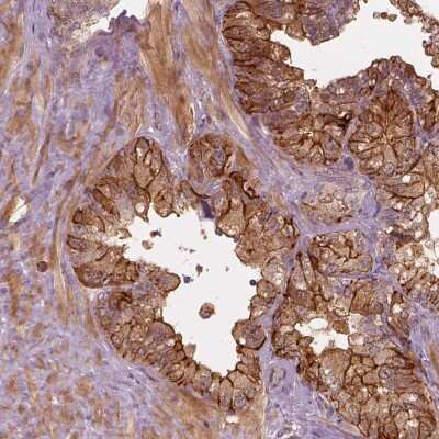 Immunohistochemistry: FAM107B Antibody [NBP2-68951]