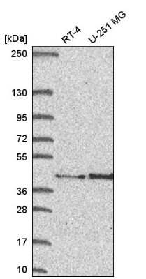 Western Blot: FAM107B Antibody [NBP2-58052]