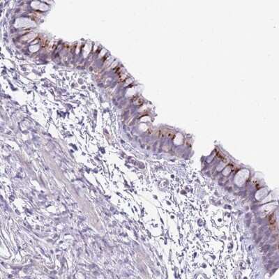 Immunohistochemistry-Paraffin: FAM108A1 Antibody [NBP2-31029]
