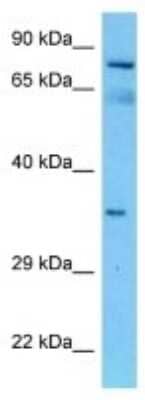 Western Blot: FAM108A1 Antibody [NBP3-10857]