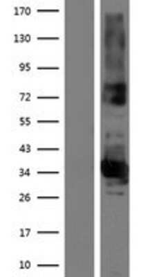 Western Blot: FAM108B1 Overexpression Lysate [NBP2-07099]