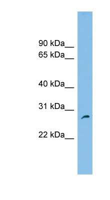 Western Blot: FAM109A Antibody [NBP1-57739]