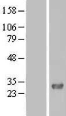 Western Blot: FAM109A Overexpression Lysate [NBL1-10441]