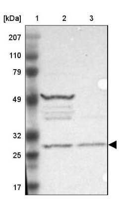 Western Blot: FAM109B Antibody [NBP1-84112]