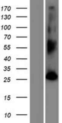 Western Blot: FAM109B Overexpression Lysate [NBP2-08946]