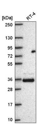 Western Blot: FAM110A Antibody [NBP2-56326]