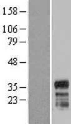 Western Blot: FAM110A Overexpression Lysate [NBP2-09924]