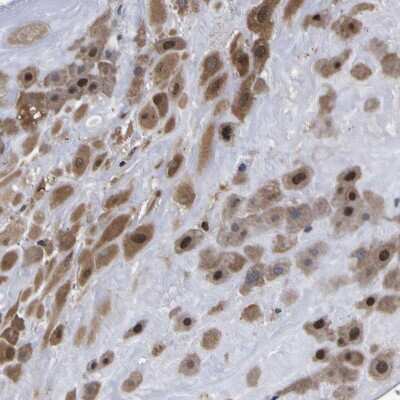 Immunohistochemistry-Paraffin: FAM110B Antibody [NBP1-86719]